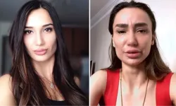 Yağmur Sarnıç neden intihar etti, ne oldu? Yağmur Sarnıç'ın sağlık durumu nasıl?