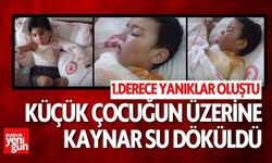 Isparta’da Küçük Çocuğun Üzerine Kaynar Su Döküldü