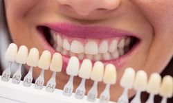 Diş Beyazlatma Yöntemleri Nelerdir?