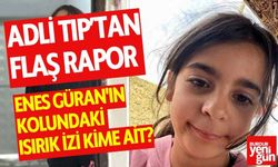 Adli Tıp’tan Flaş Rapor: Isırık İzi Kime Ait?