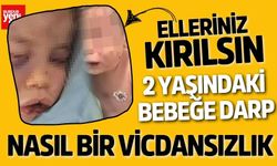 2 yaşındaki bebeği darp ettiler