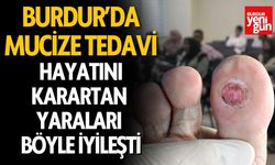 Burdur’da Mucize Tedavi: Diyabetik Yara Ozonla İyileşti