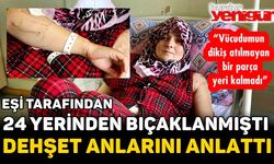 24 yerinden bıçaklanmıştı; dehşet anlarını anlattı