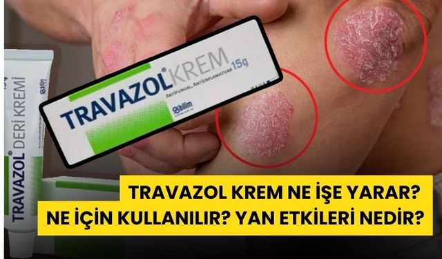 Travazol Krem Nedir, Kaşıntıya ve Mantar Enfeksiyonlarına İyi Gelir Mi?