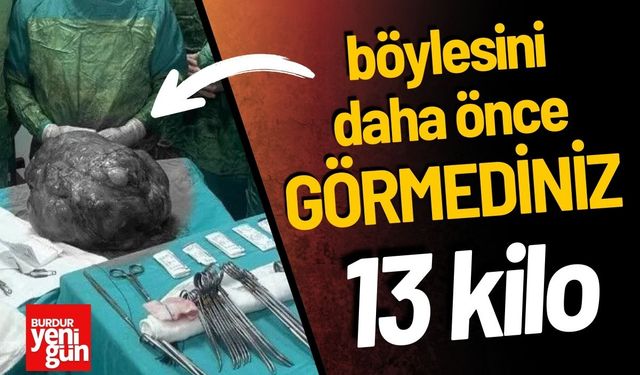 Hastanın Karnından Öyle Birşey Çıktı ki...