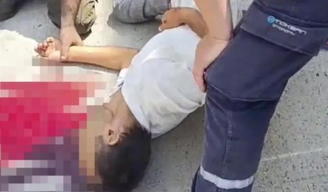Tamircileri izleyen şoförün başı damper kapağına sıkıştı