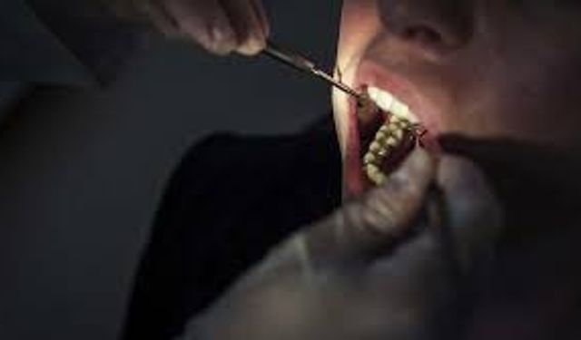 Gömülü 20 yaş dişleri nelere sebep olur?