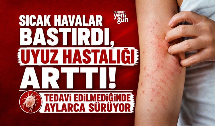 Sıcak havalar bastırdı, uyuz hastalığı arttı! Tedavi edilmediğinde aylarca sürüyor