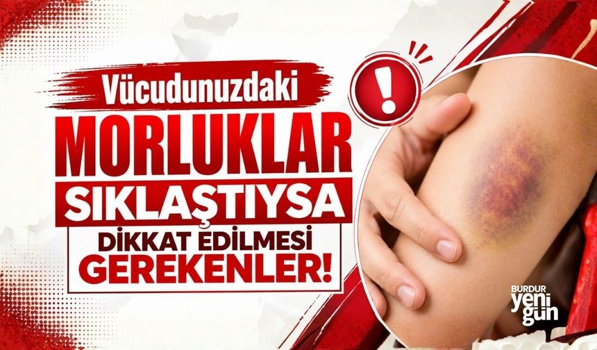 Vücudunuzdaki morluklar sıklaştıysa dikkat edilmesi gerekenler!